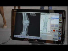 Load and play video in Gallery viewer, Metron-DVM bundle kit + touchscreen PC: Your equine X-rays analyzed in seconds!
